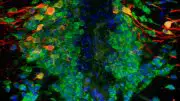 Dopamine-Producing Nerve Cells in the Zebrafish Brain