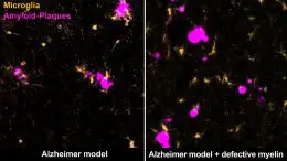 Microglia Amyloid Plaques Mouse Brain