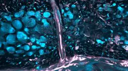 Mmune Cells in Blue and Vessels in Pink in the Bone Marrow of the Skull
