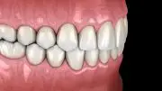 Oral Health Concept